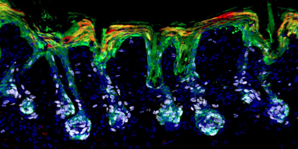 Vitamin A may play a central role in stem cell biology and wound repair