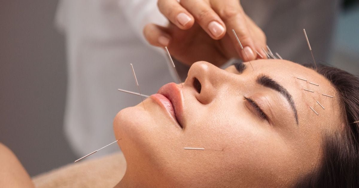 Struggle with anxiety? Acupuncture could help with that