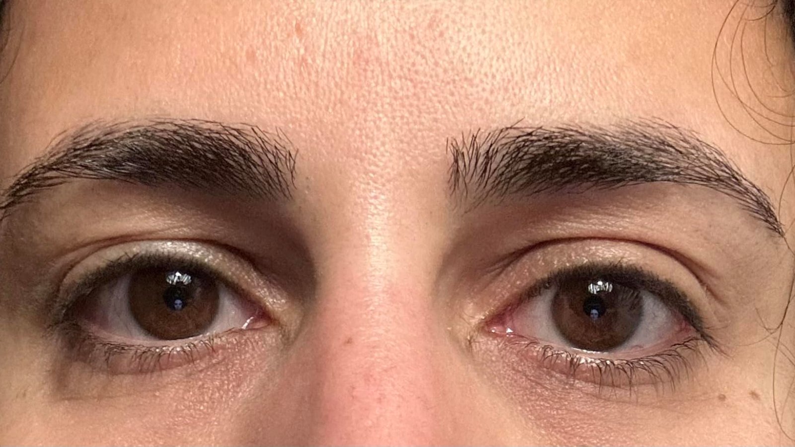 11 between the eyes feels softer,” says a shopper who bought Anti-Aging on Amazon, who also rave about the smoothness on her forehead.