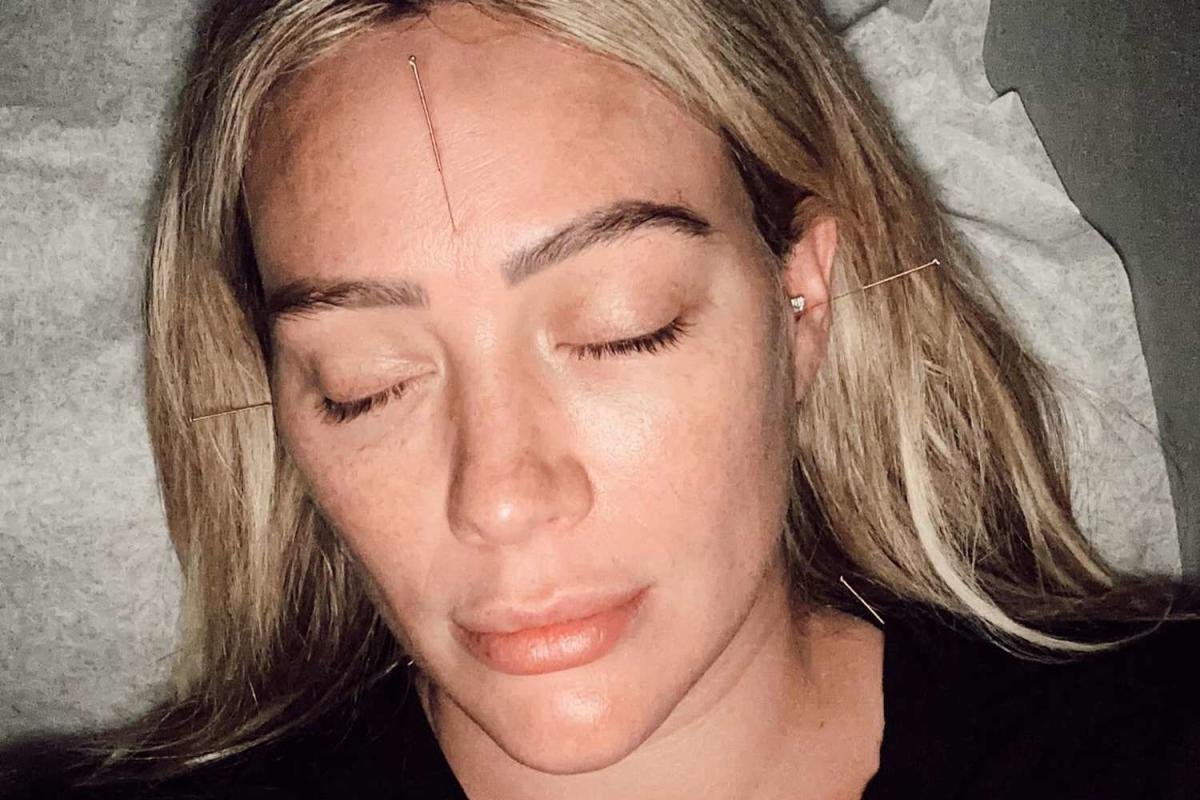 Pregnant Hilary Duff receives acupuncture treatment as she tries to gently give her eviction notice to her baby