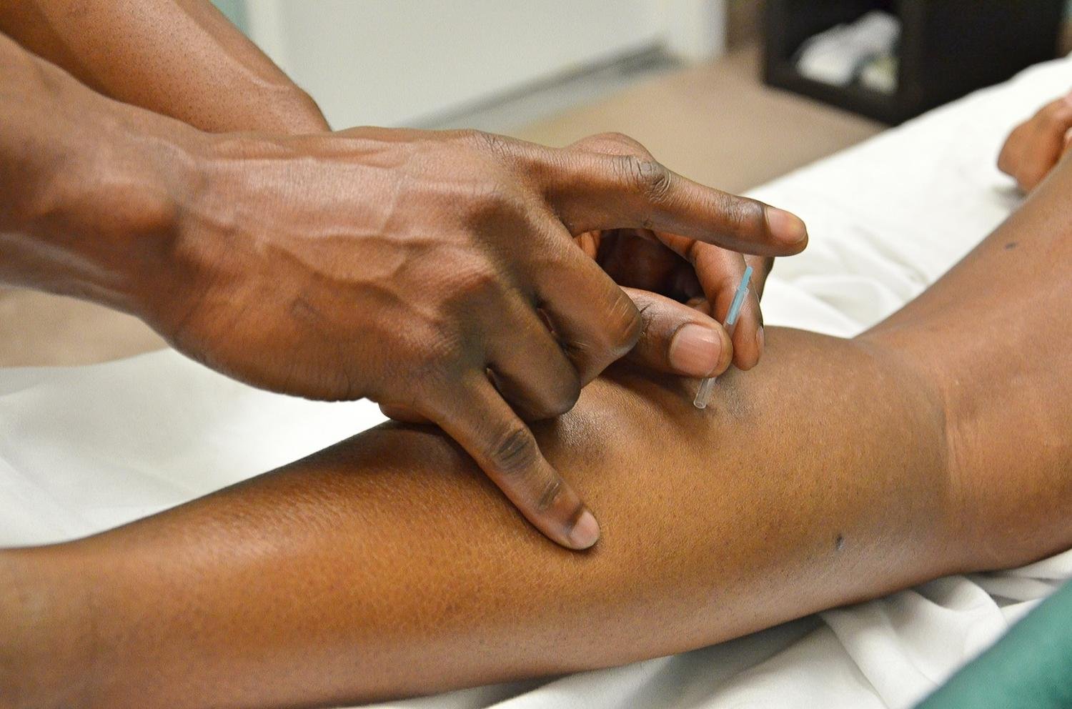 Acupuncture may provide limited relief for patients with chronic urticaria