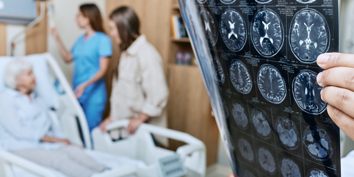 Acupuncture for Stroke Patients | Acupuncture Today