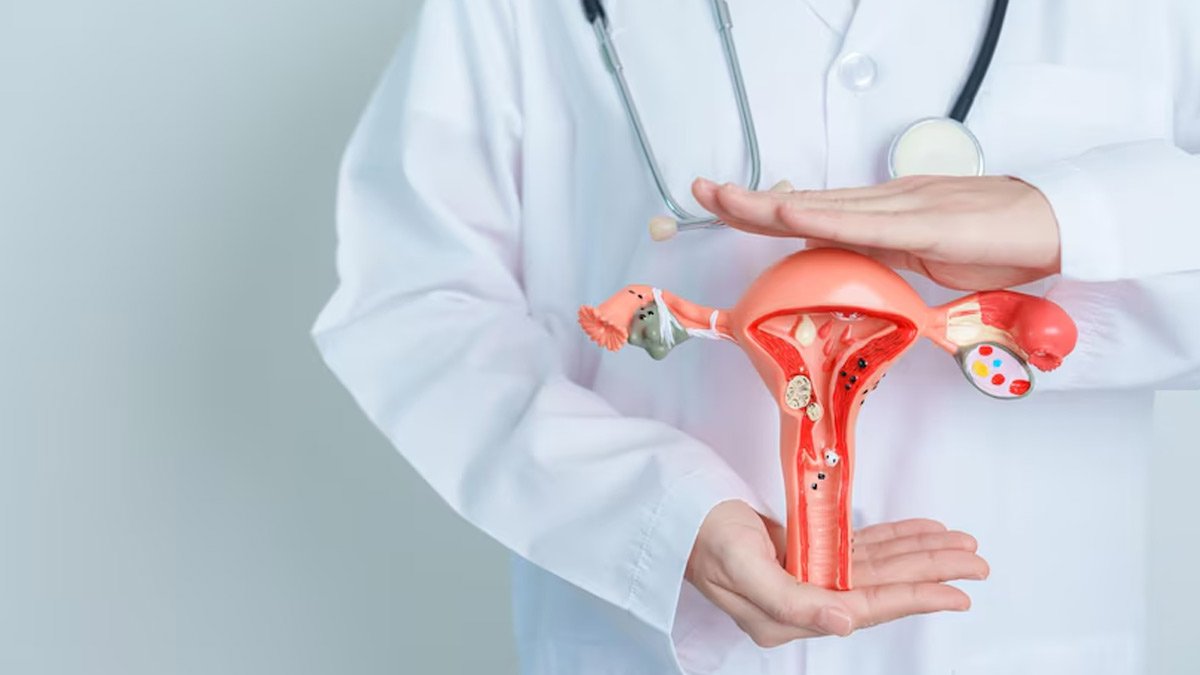 Why do I need to take vitamin D to manage PCOS? Here’s what doctors recommend