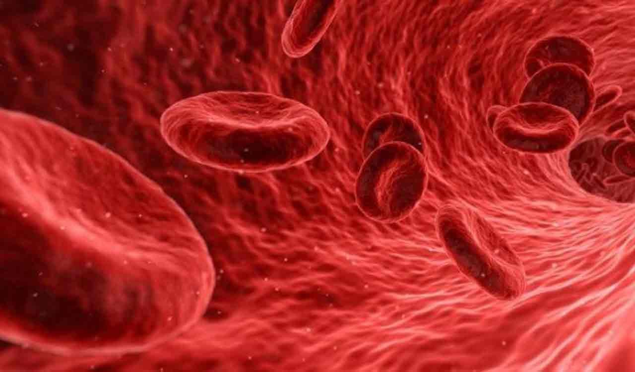 Natural remedies help treat blood clots – Telangana Today