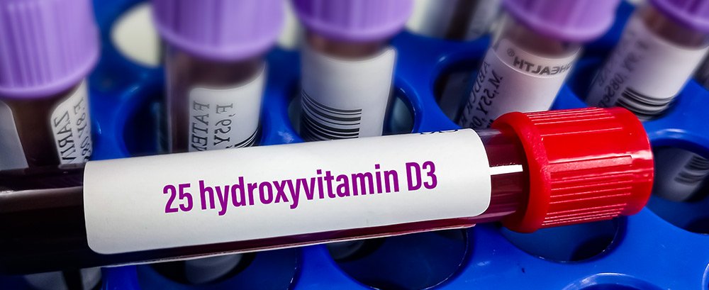 Vitamin D is more important than you think – T Nation Content