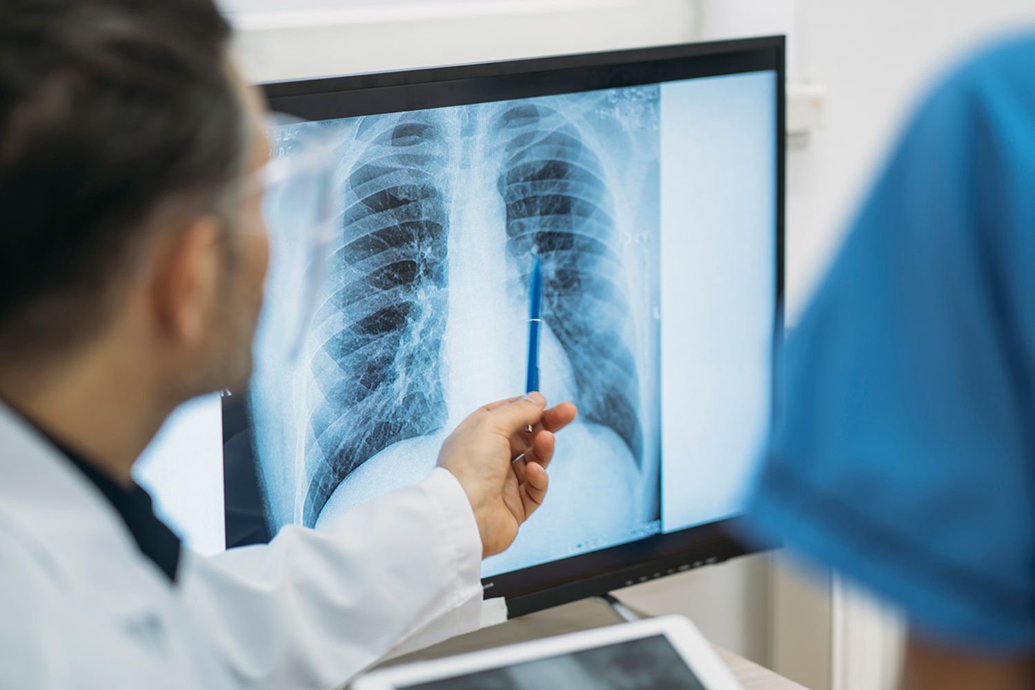 Jet-lagged woman accidentally swallows wedding ring